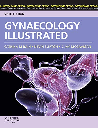 Gynaecology Illustrated 6/e
