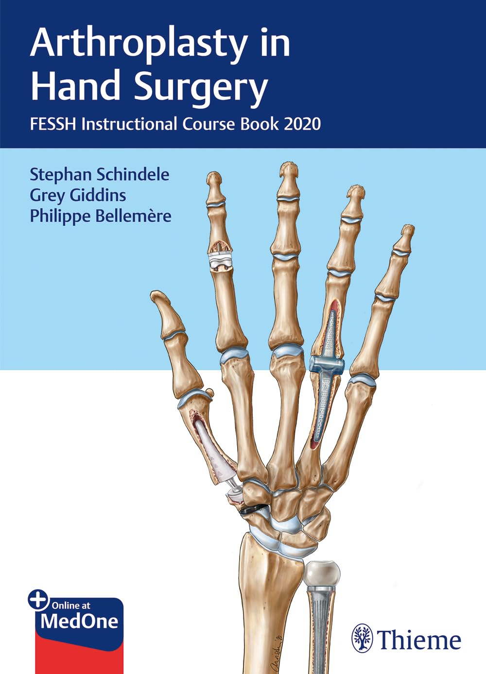 Arthroplasty in Hand Surgery : FESSH Instructional Course Book 2020 1st Ed.