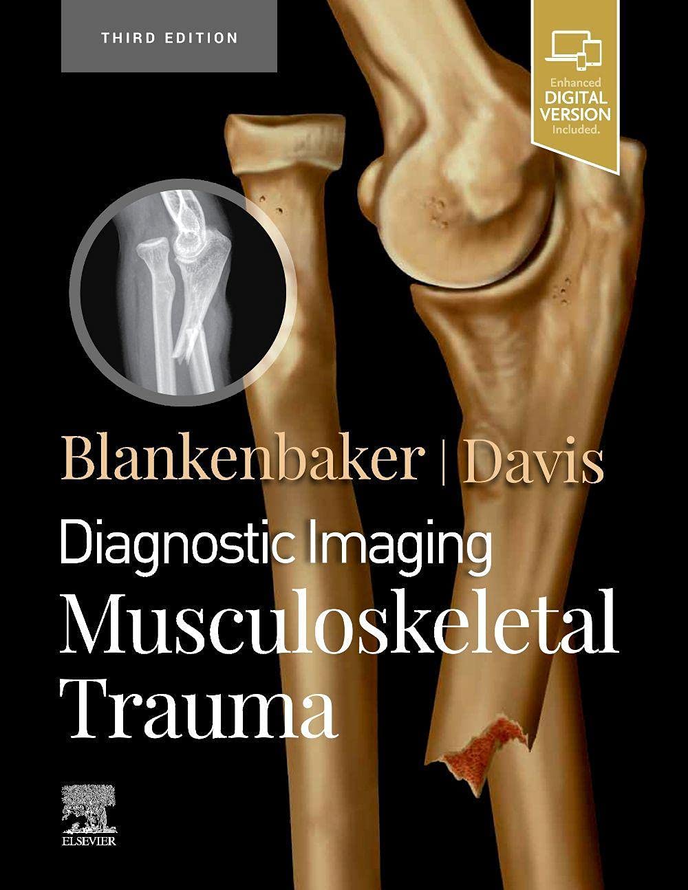 Diagnostic Imaging: Musculoskeletal Trauma-3ED
