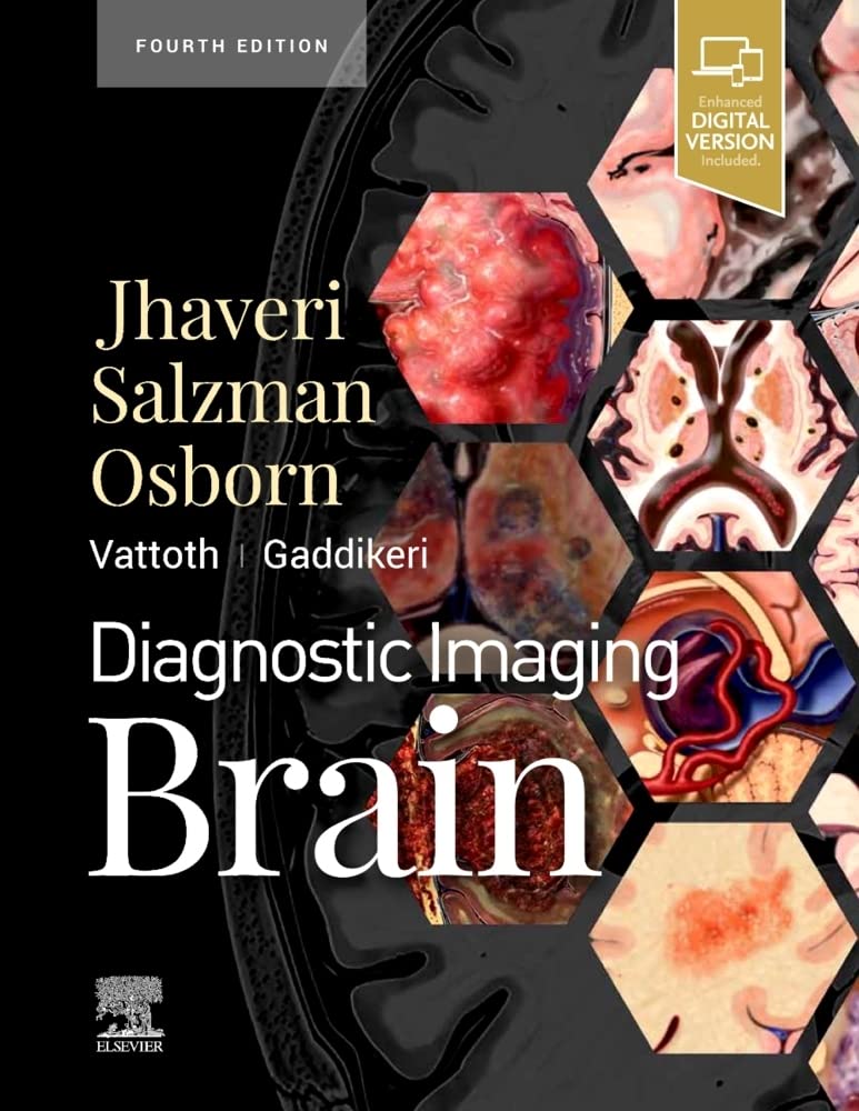 Diagnostic Imaging: Brain-4ED
