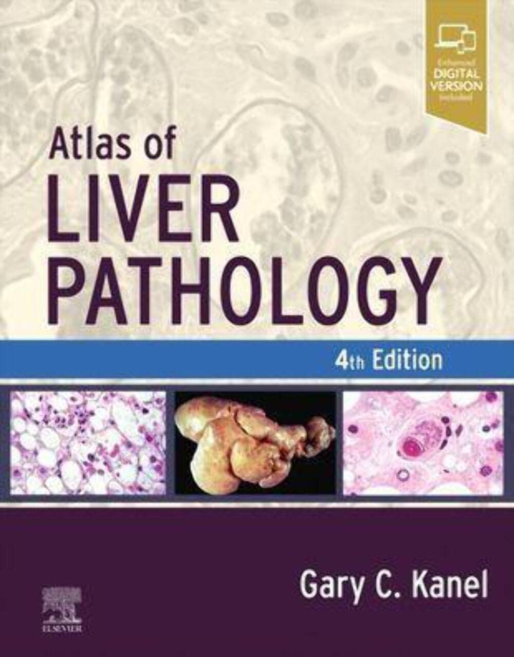 ATLAS OF LIVER PATHOLOGY: 4ED
