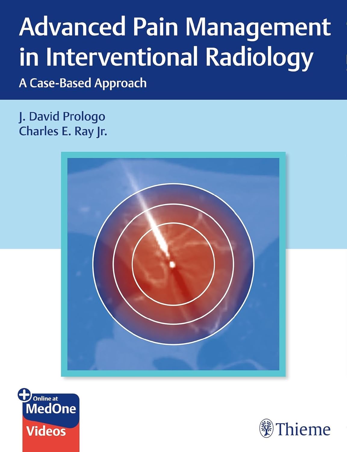 Advanced Pain Management in Interventional Radiology 1st Ed.