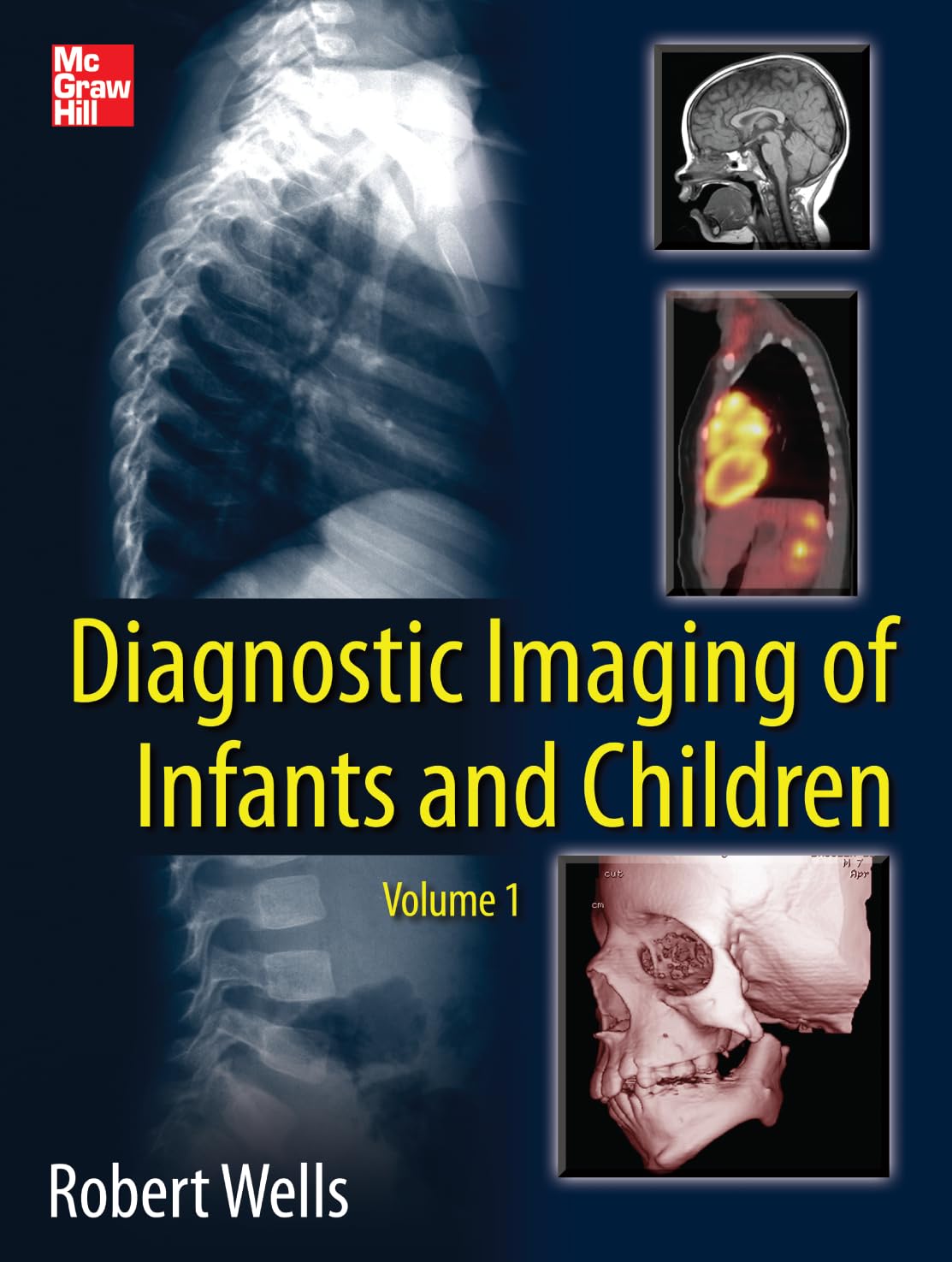DIAGNOSTIC IMAGING OF INFANTS AND CHILDREN (Hardcover)