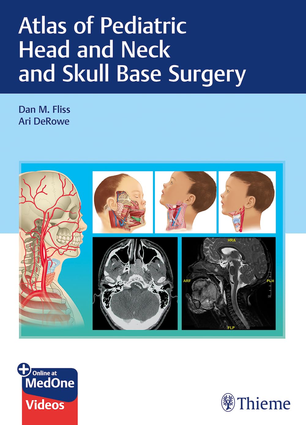 Atlas of Pediatric Head and Neck and Skull Base Surgery 1st Ed.