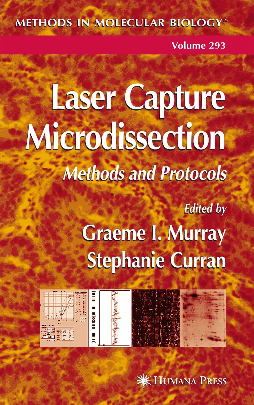 LASER CAPTURE MICRODISSECTION: METHODS AND PROTOCOLS