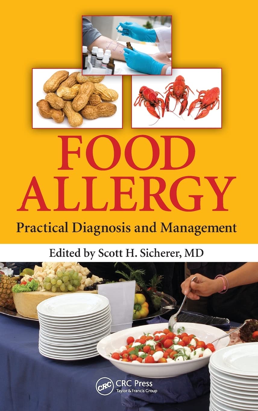 Food Allergy: Practical Diagnosis and Management