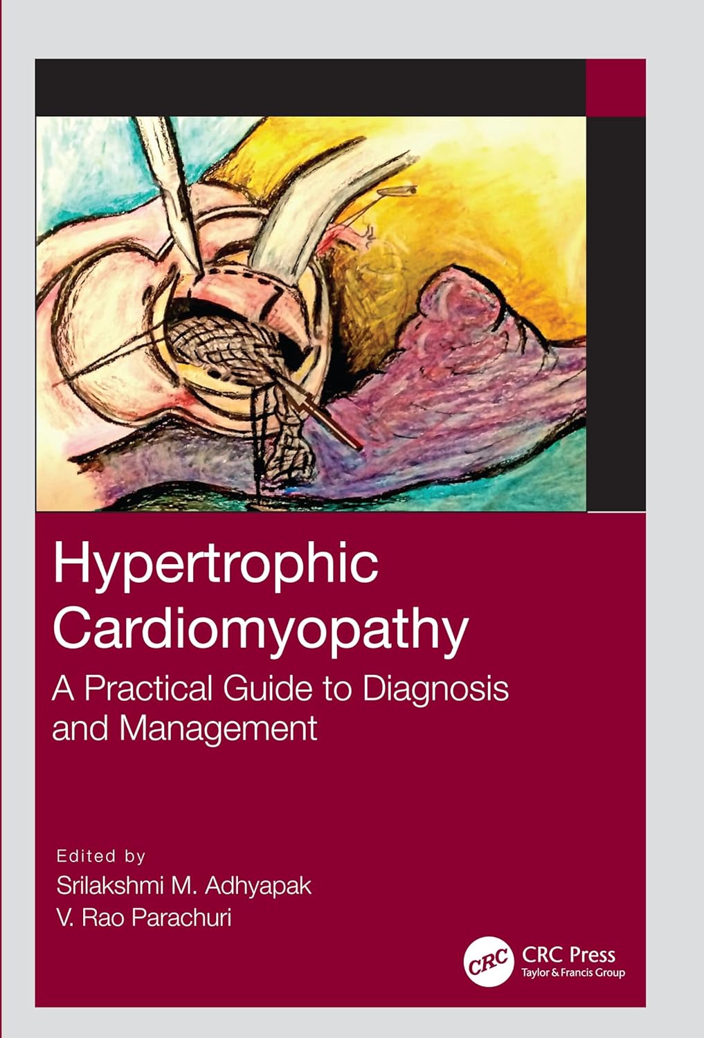 HYPERTROPHIC CARDIOMYOPATHY A PRACTICAL GUIDE TO DIAGNOSIS AND MANAGEMENT (Paperback 2020)