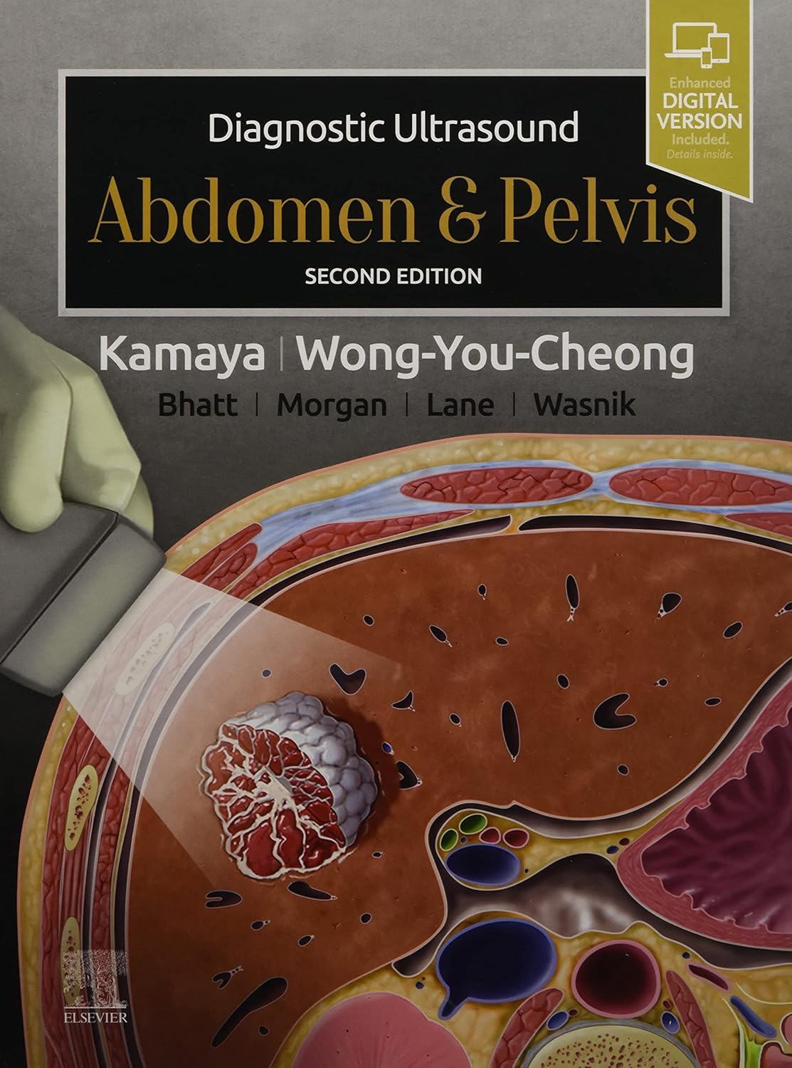 DIAGNOSTIC ULTRASOUND: ABDOMEN AND PELVIS 2ED (Hardcover)