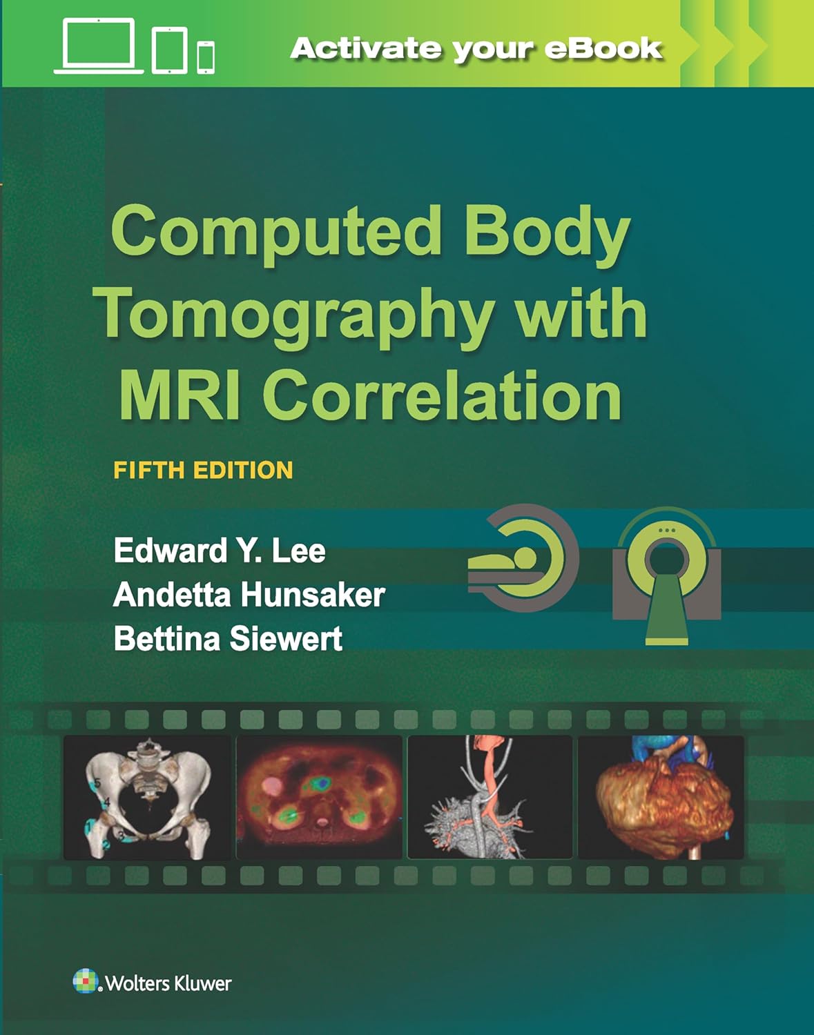 Computed Body Tomography with MRI Correlation - 5E