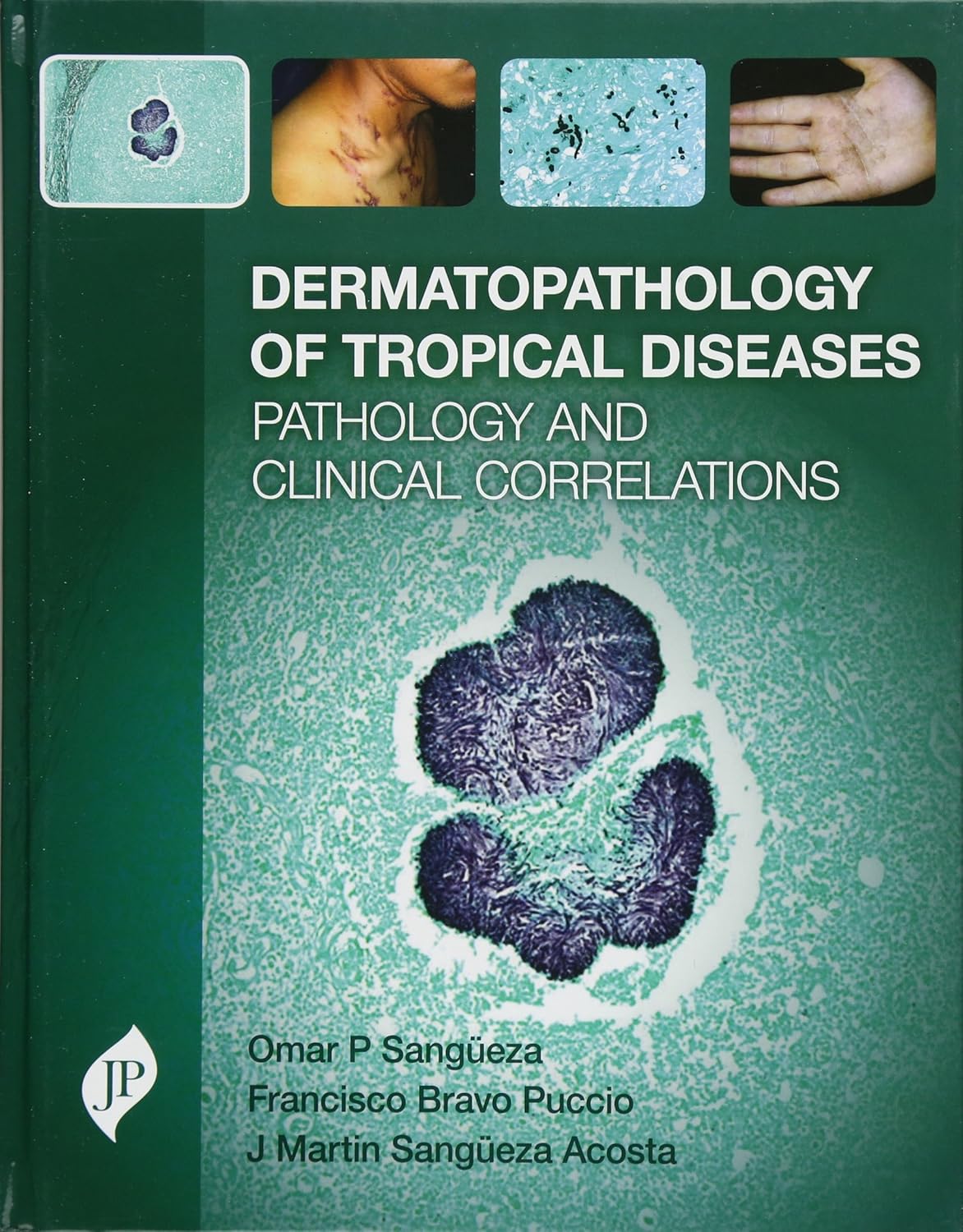 Dermatopathology of Tropical Diseases
