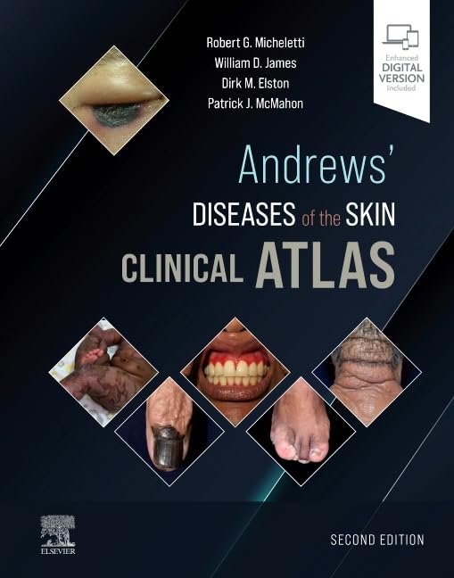 Andrews' Diseases of the Skin Clinical Atlas - 2E