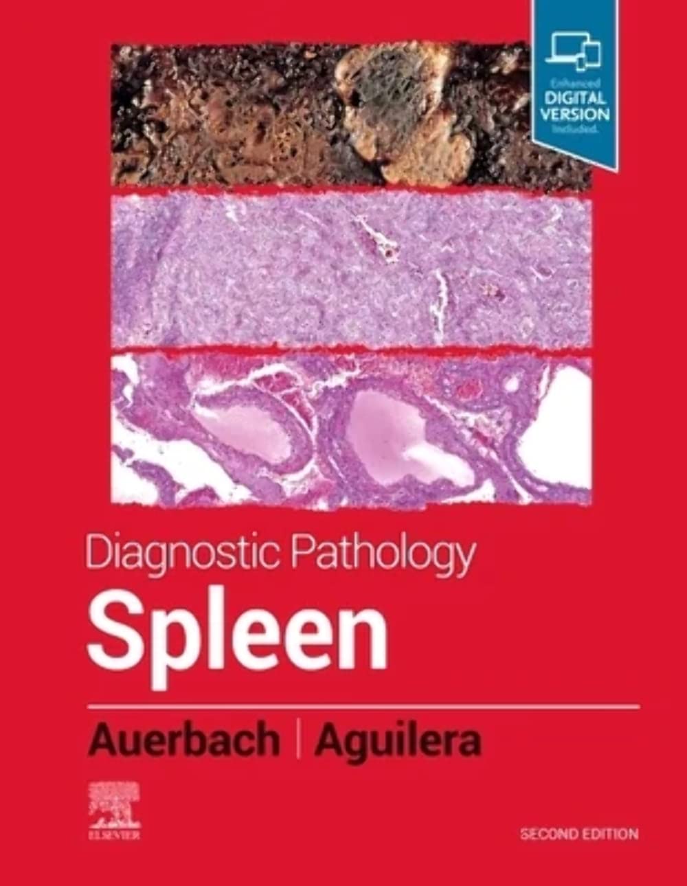 DIAGNOSTIC PATHOLOGY : SPLEEN WITH ACCESS CODE 2ED (Hardcover 2022)
