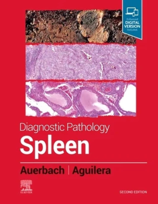DIAGNOSTIC PATHOLOGY : SPLEEN WITH ACCESS CODE 2ED (Hardcover 2022)