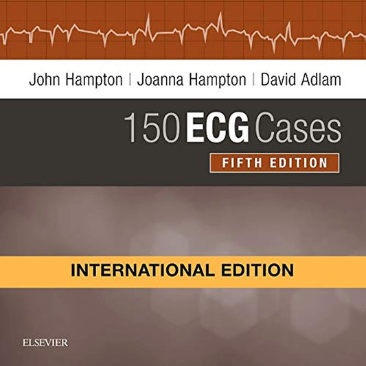 150 ECG Cases(IE) -5E