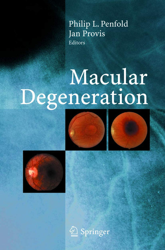 MACULAR DEGENERATION