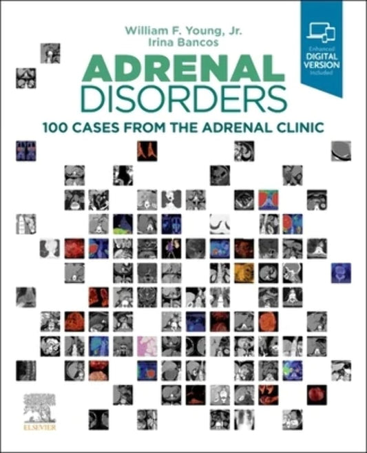 Adrenal Disorders: 100 Cases from the Adrenal Clinic - 1E