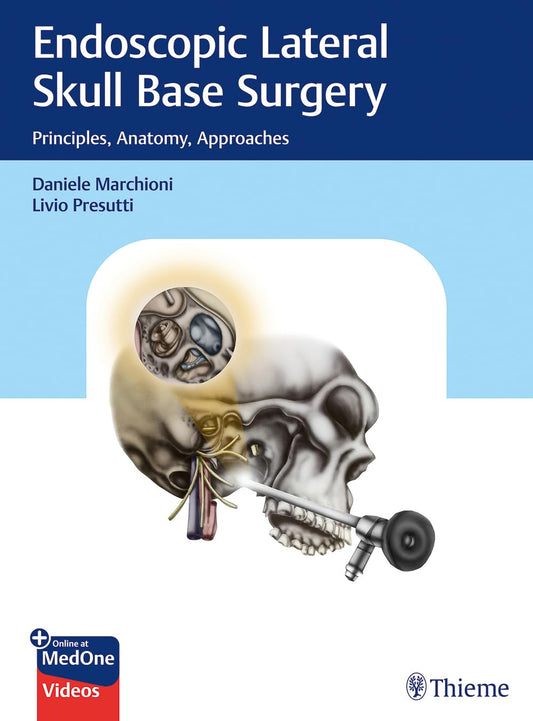 Endoscopic Lateral Skull Base Surgery : Principles, Anatomy, Approaches 1st Ed.