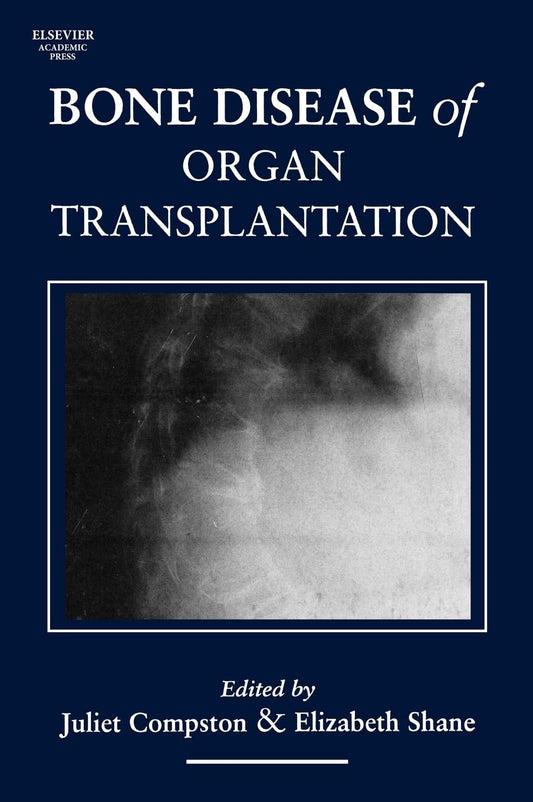 BONE DISEASE OF ORGAN TRANSPLANTATION (Hardcover)
