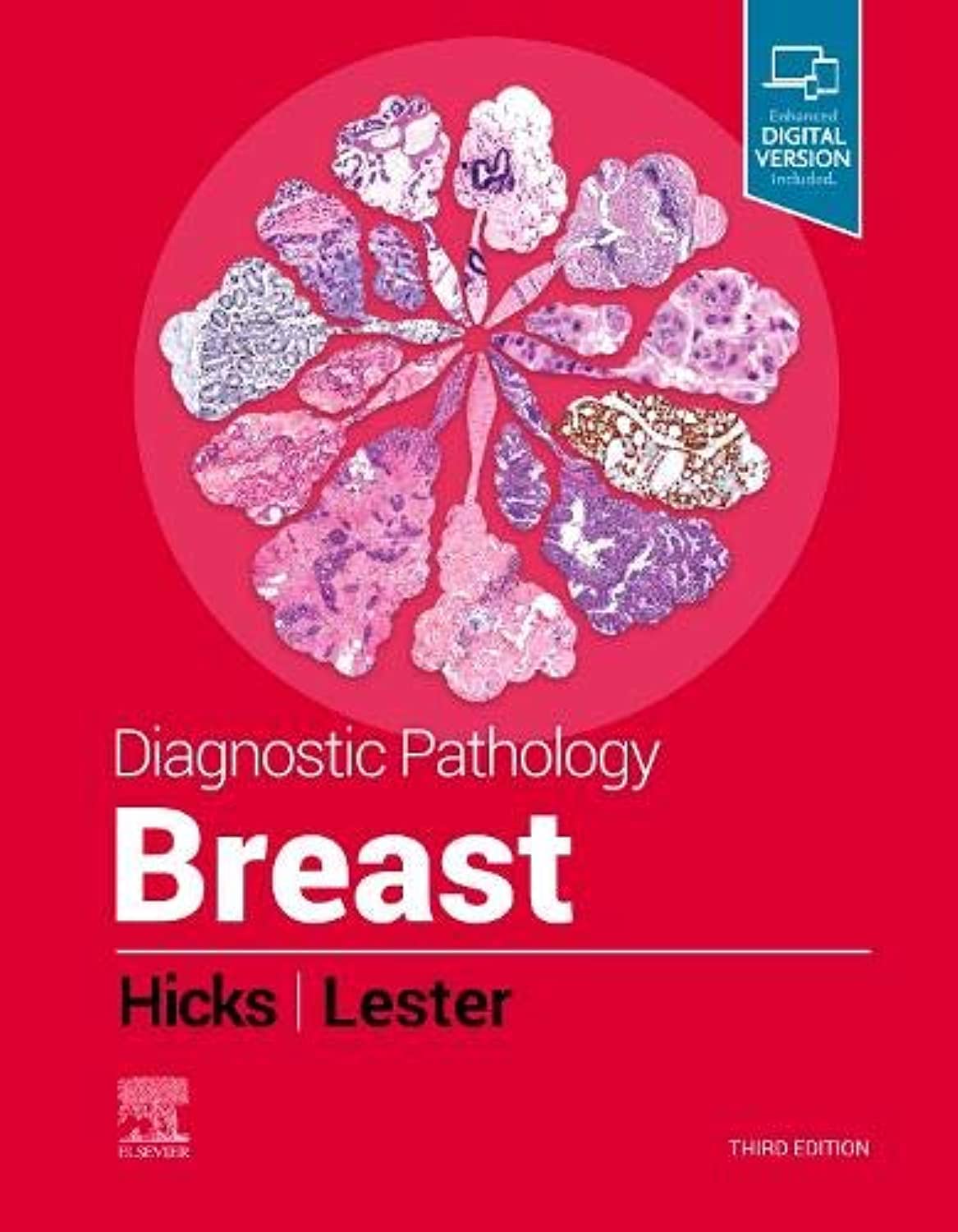Diagnostic Pathology: Breast -3ED