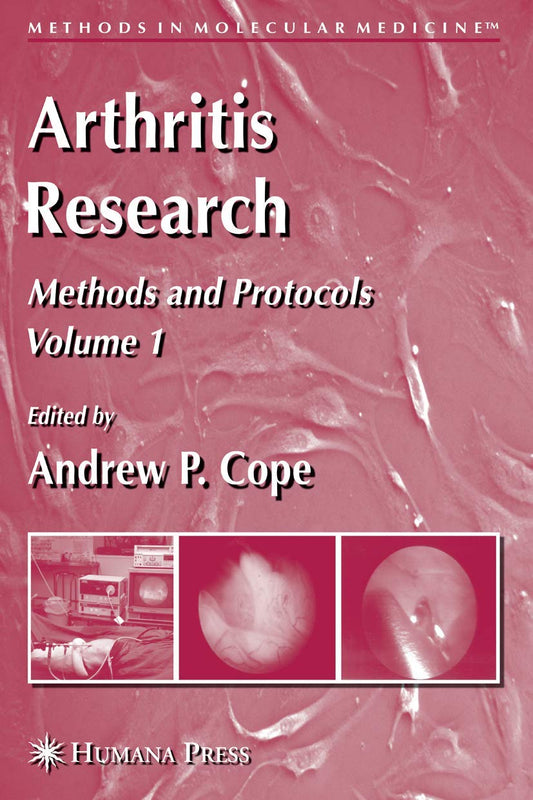ARTHRITIS RESEARCH: VOLUME 1: METHODS AND PROTOCOLS