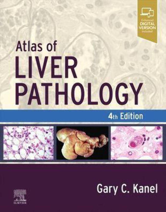 ATLAS OF LIVER PATHOLOGY:  4ED