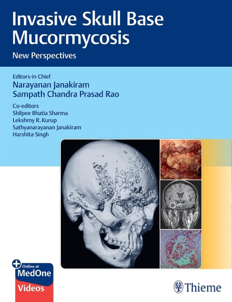 Invasive Skull Base Mucormycosis 1st Ed.