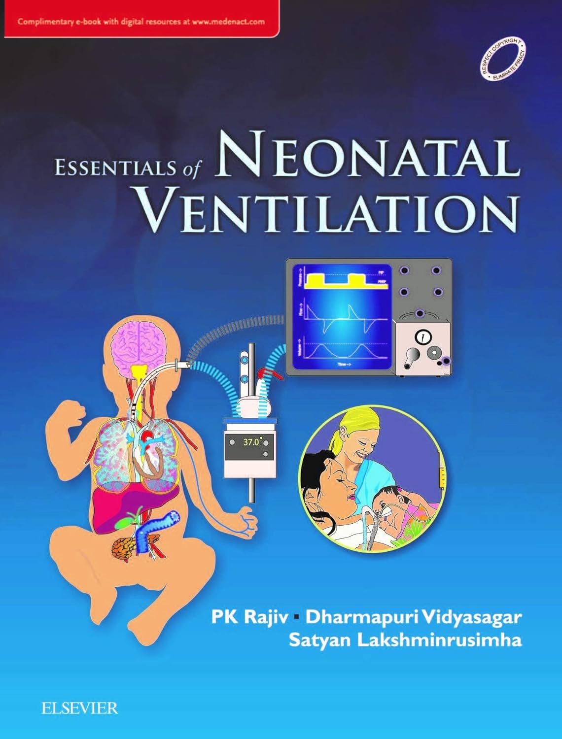 Essentials of Neonatal Ventilation -1E