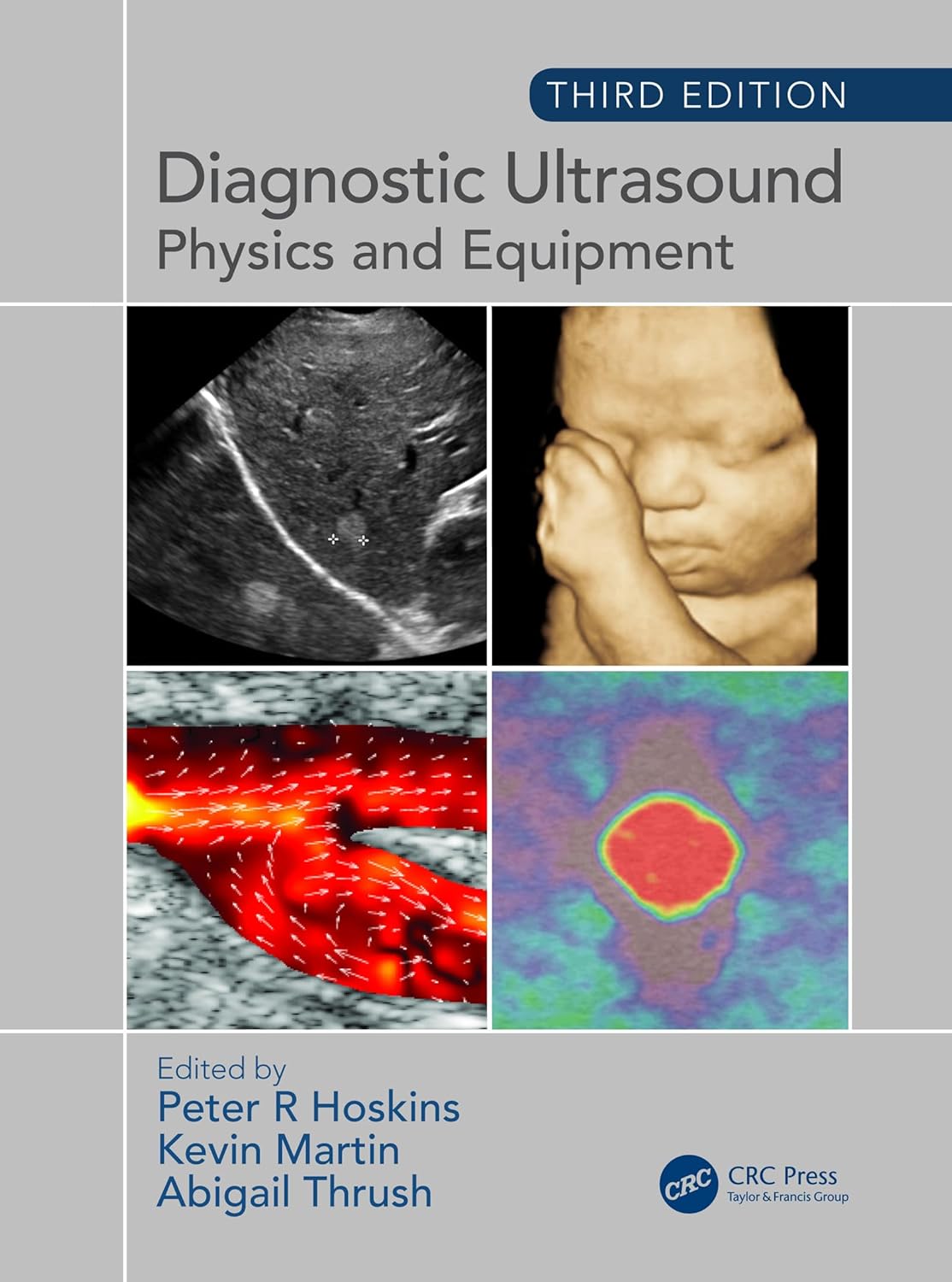 DIAGNOSTIC ULTRASOUND PHYSICS AND EQUIPMENT 3ED (Hardcover 2019)