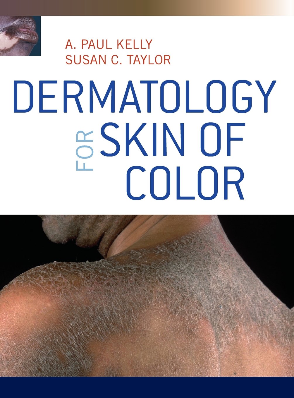 DERMATOLOGY FOR SKIN OF COLOR  (Hardcover 2009)