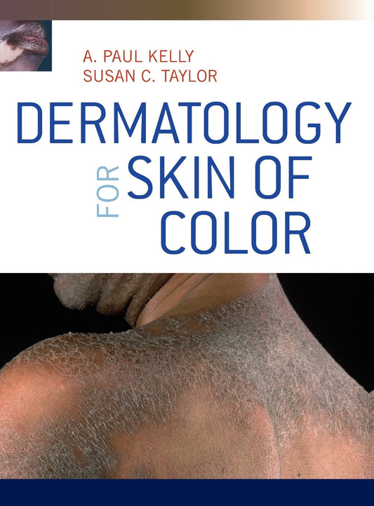DERMATOLOGY FOR SKIN OF COLOR  (Hardcover 2009)