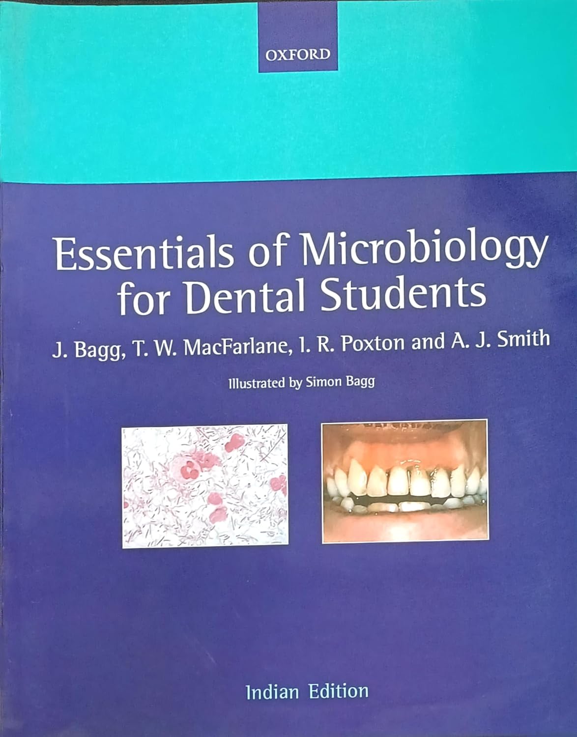 ESSENTIALS OF MICROBIOLOGY FOR DENTAL STUDENTS