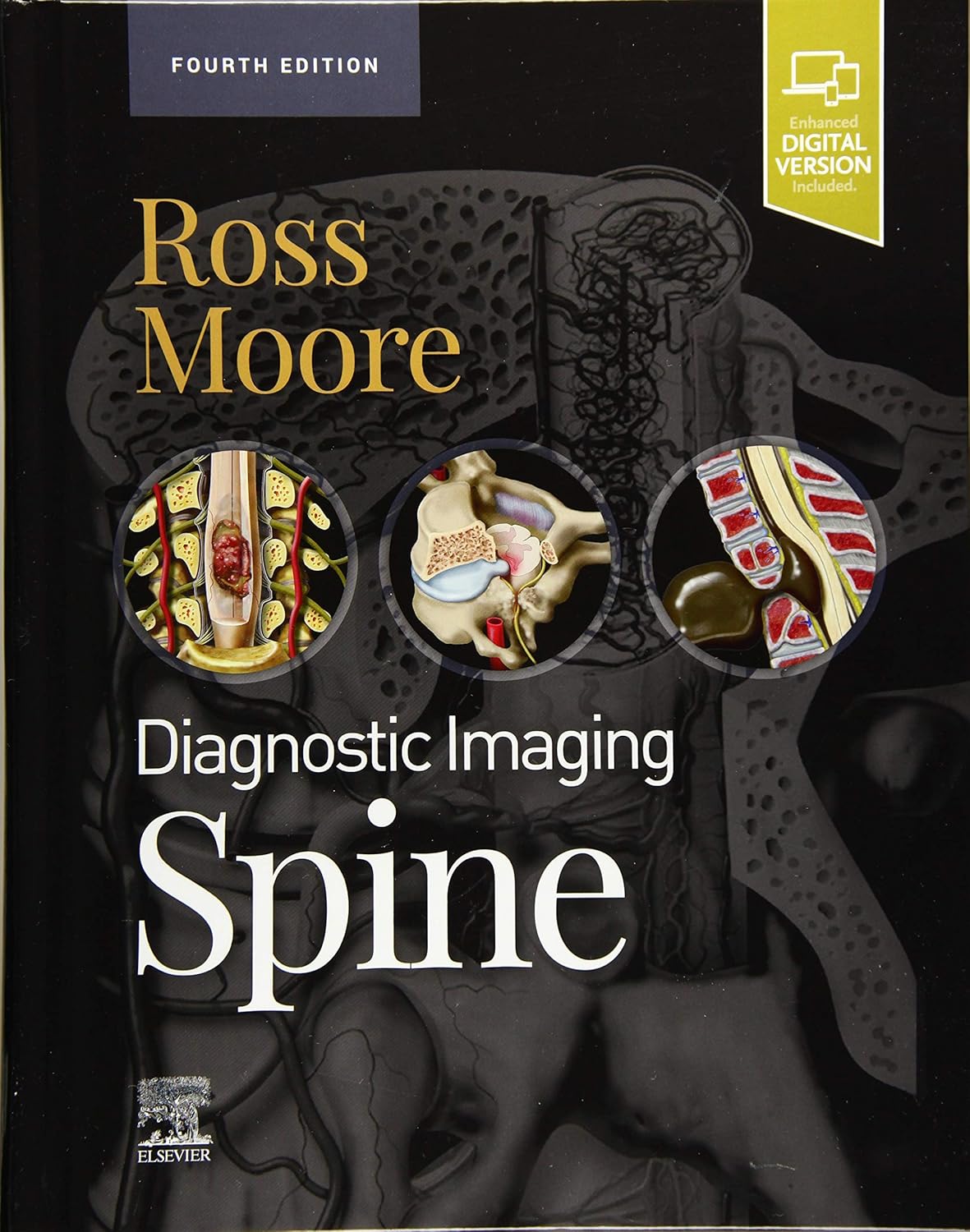 Diagnostic Imaging: Spine -4ED