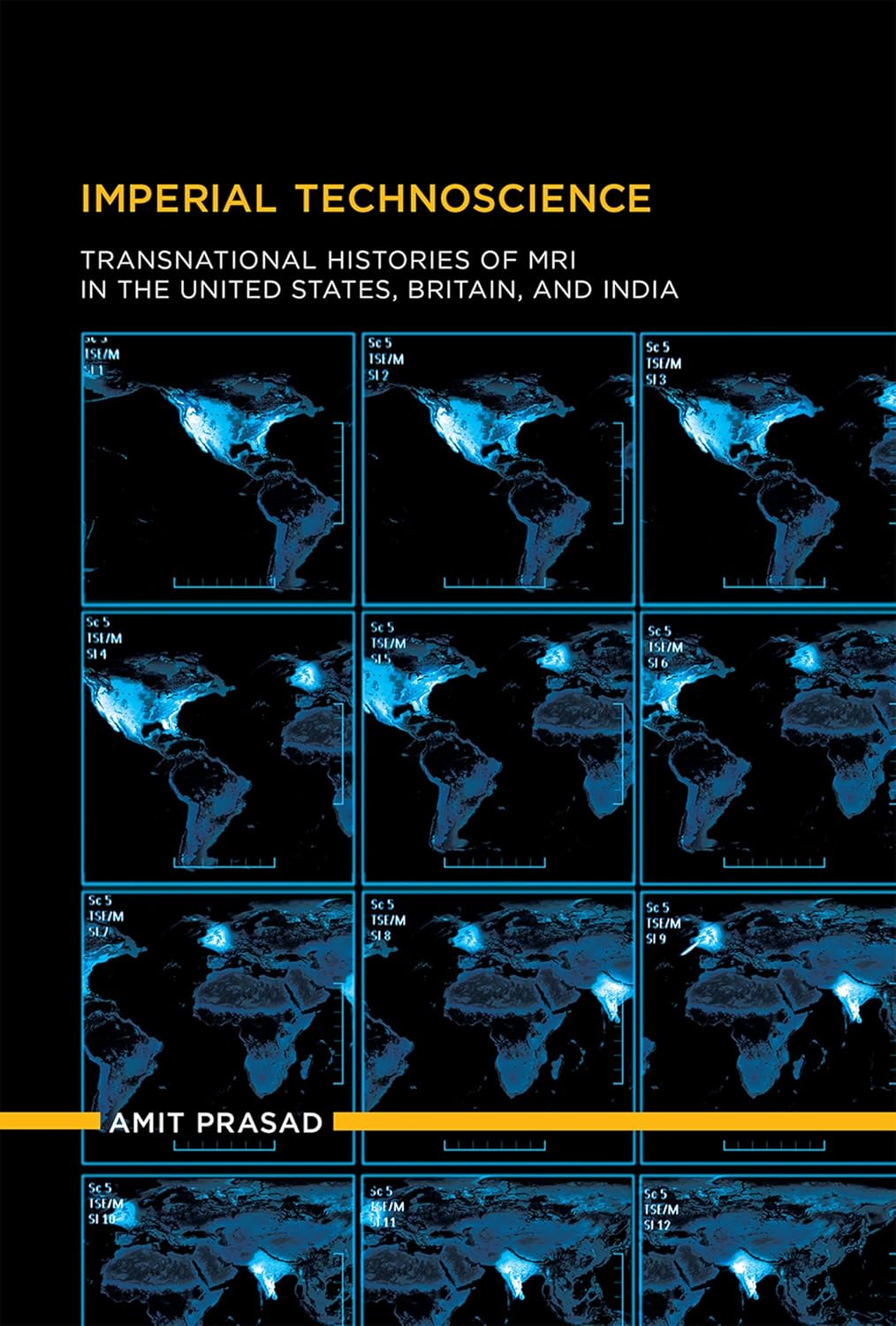 IMPERIAL TECHNOSCIENCE: TRANSNATIONAL HISTORIES OF MRI IN THE UNITED STATES, BRITAIN ,AND INDIA