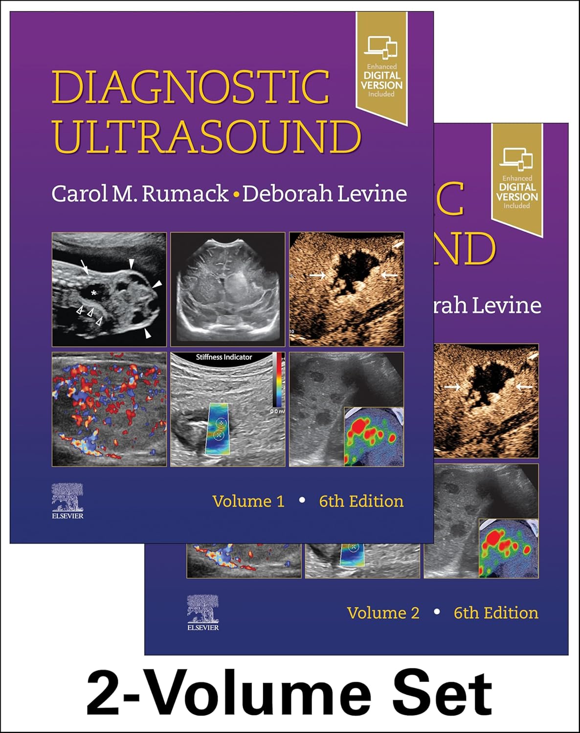 Diagnostic Ultrasound, 2-Volume Set,RUMACK