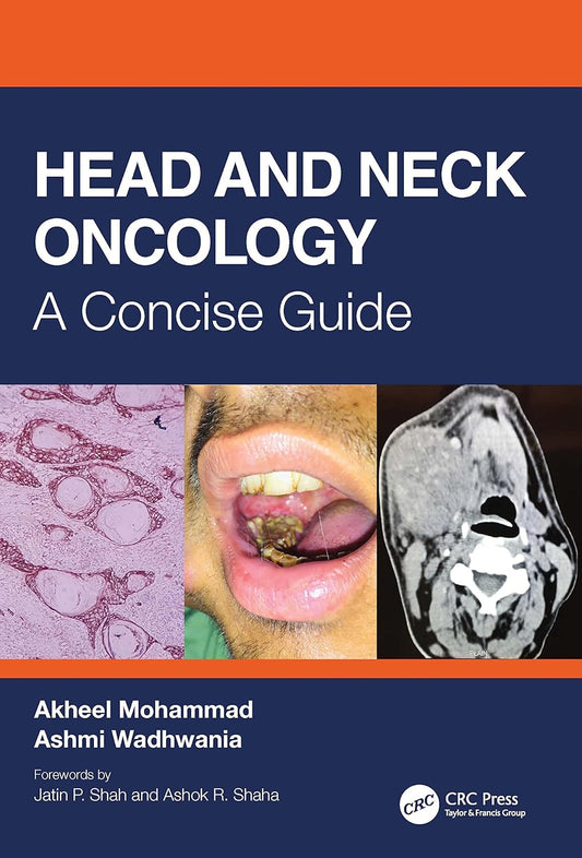 HEAD AND NECK ONCOLOGY : A CONCISE GUIDE (Paperback 2021)