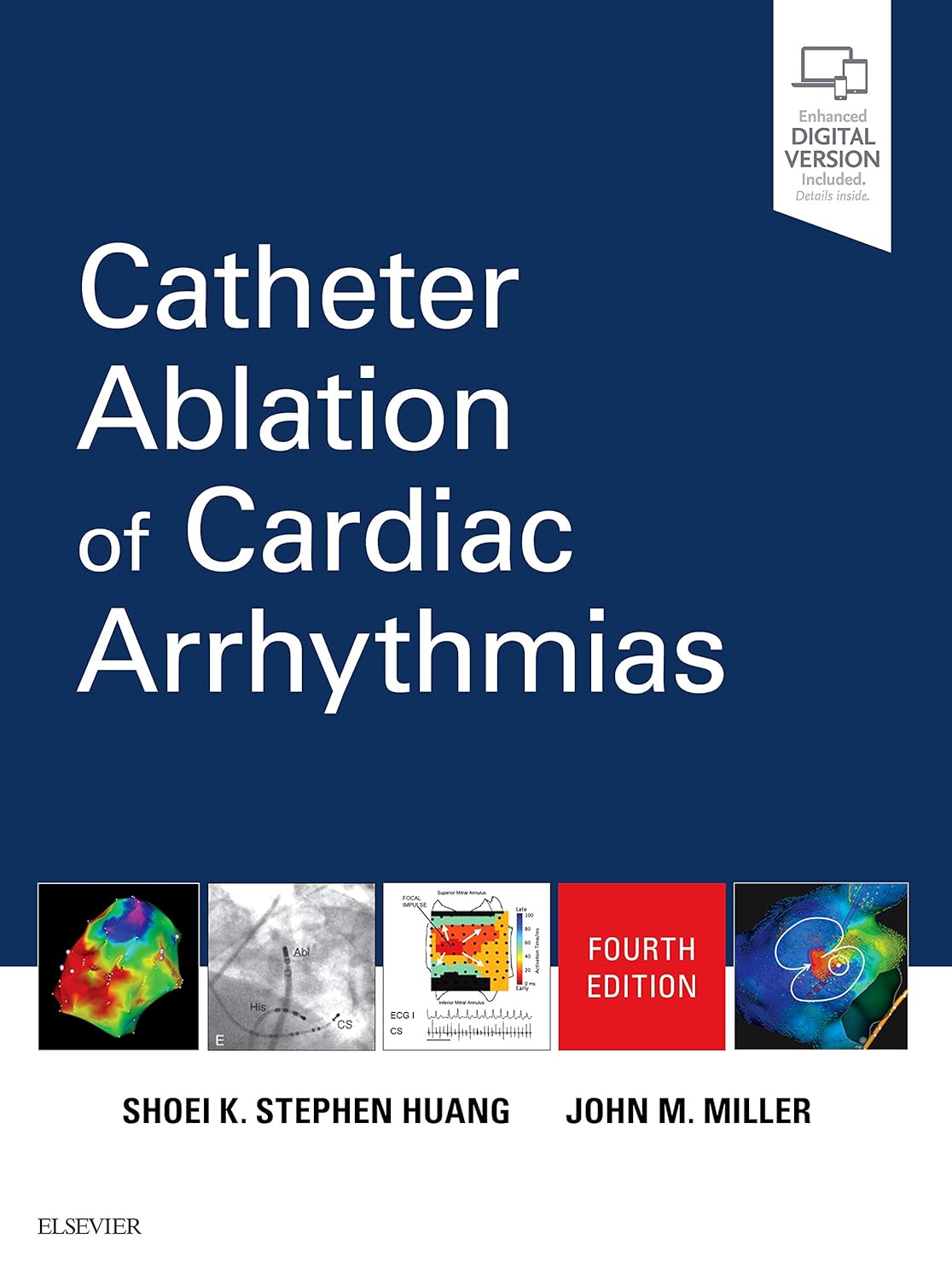 CATHETER ABLATION OF CARDIAC ARRHYTHMIAS WITH ACCESS CODE 4ED (Hardcover)