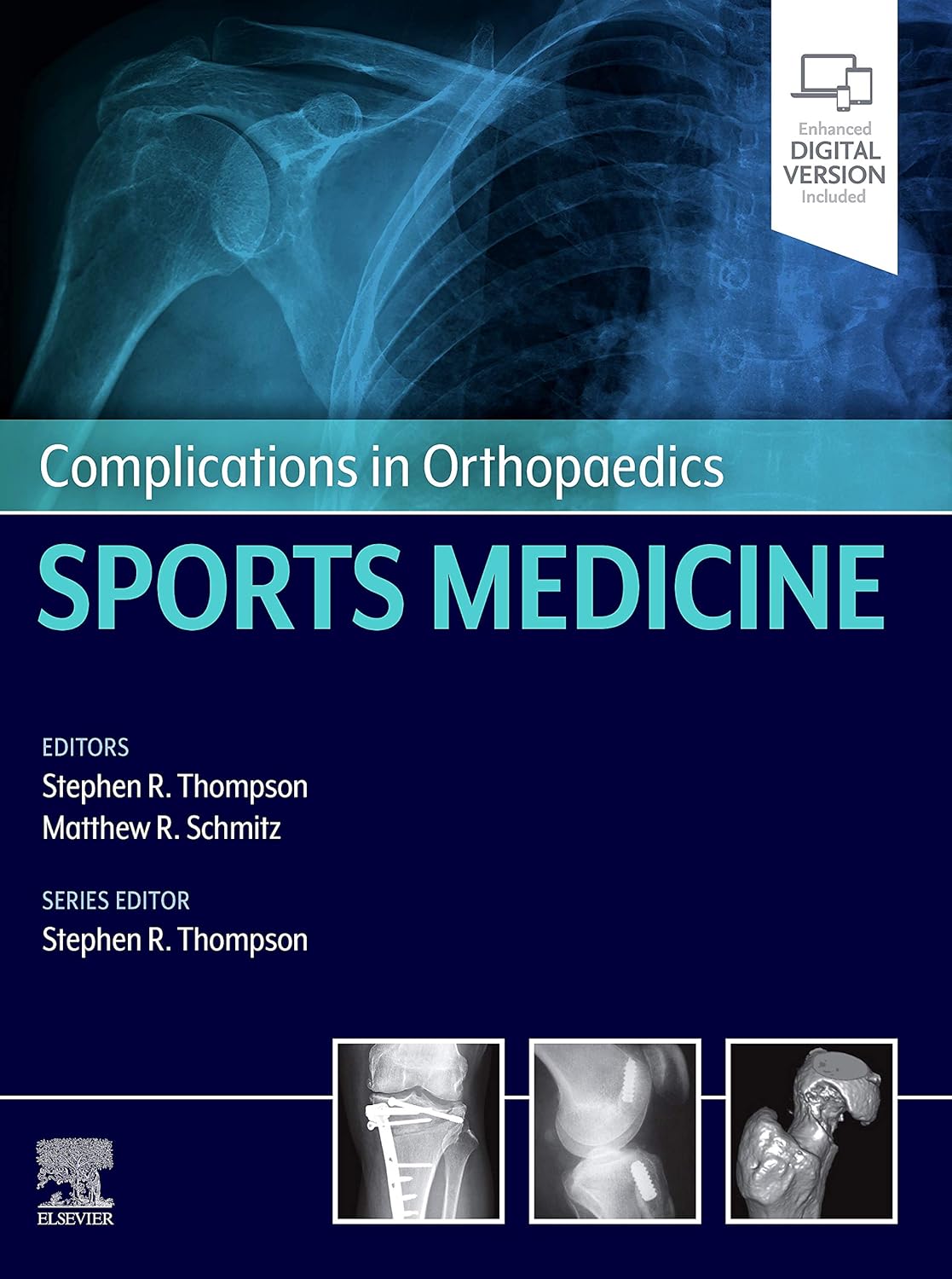 COMPLICATIONS IN ORTHOPAEDICS  : SPORTS MEDICINE (Hardcover)