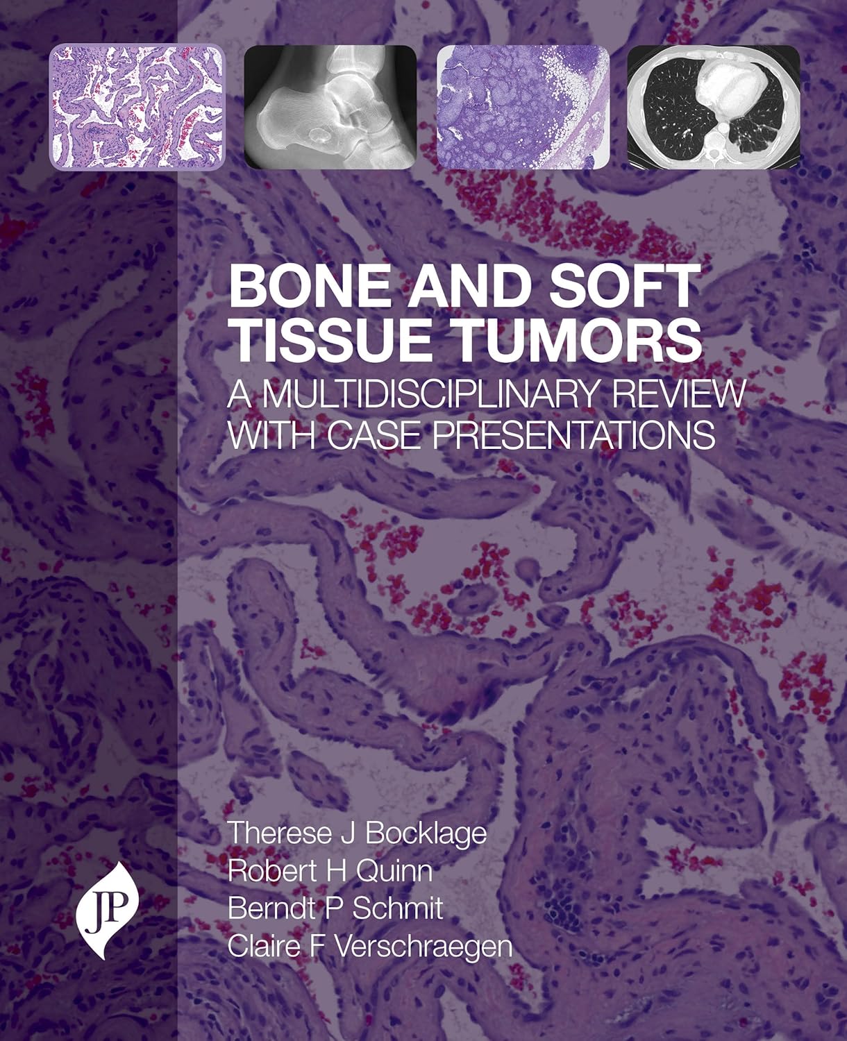 Bone and Soft Tissue Tumors: A Multidisciplinary Review with Case Presentations