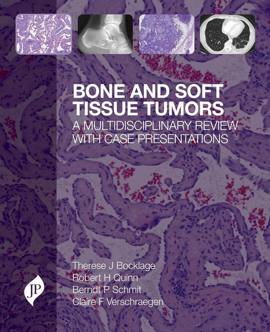 Bone and Soft Tissue Tumors: A Multidisciplinary Review with Case Presentations
