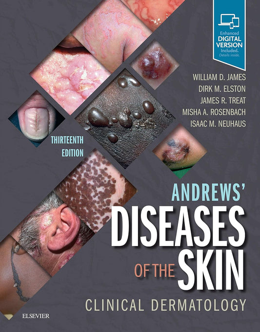 Andrews' Diseases of the Skin-13E
