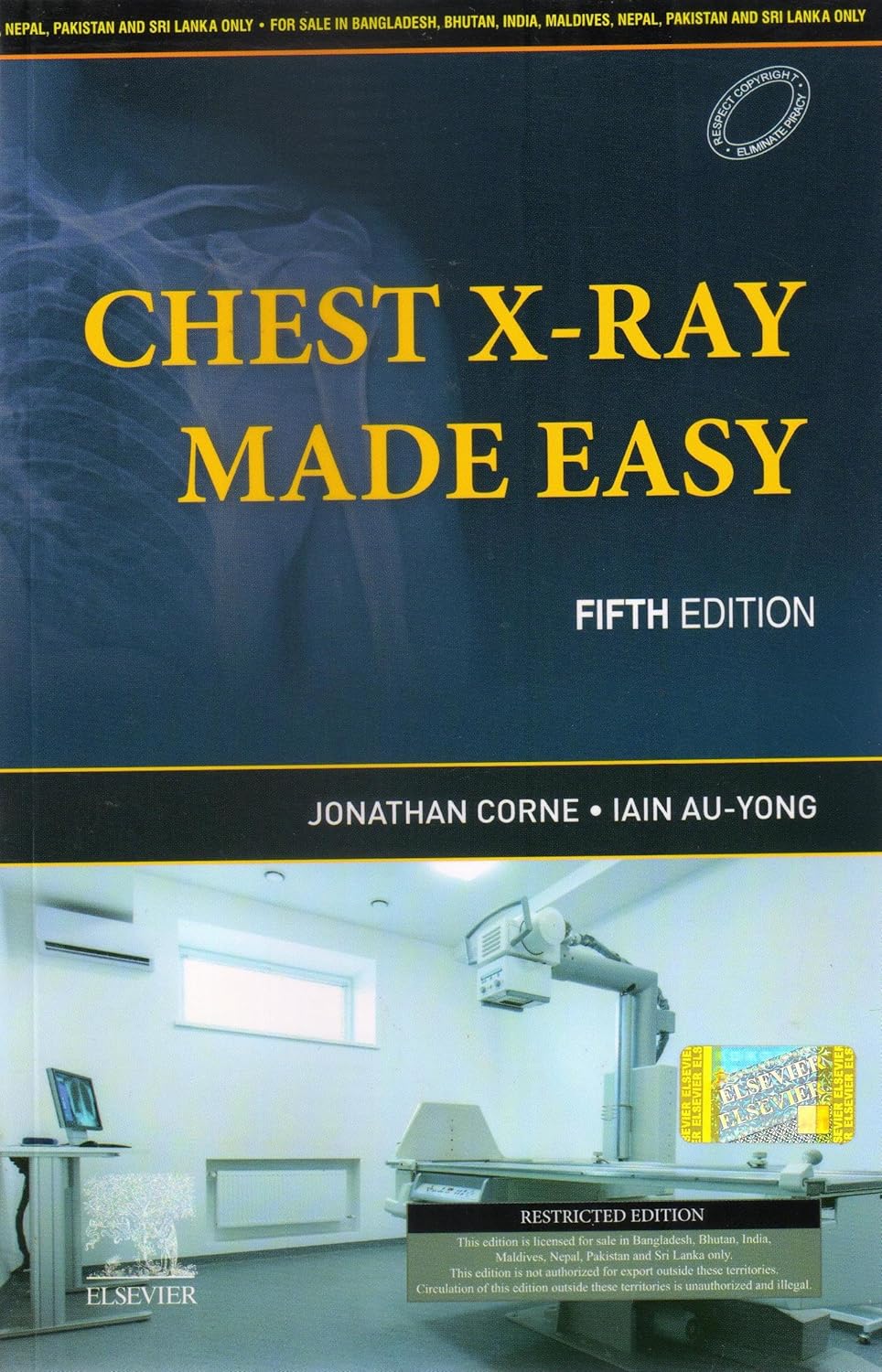Chest X-Ray Made Easy (SAE) -5E