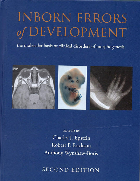 Inborn Errors Of Development 2Ed
