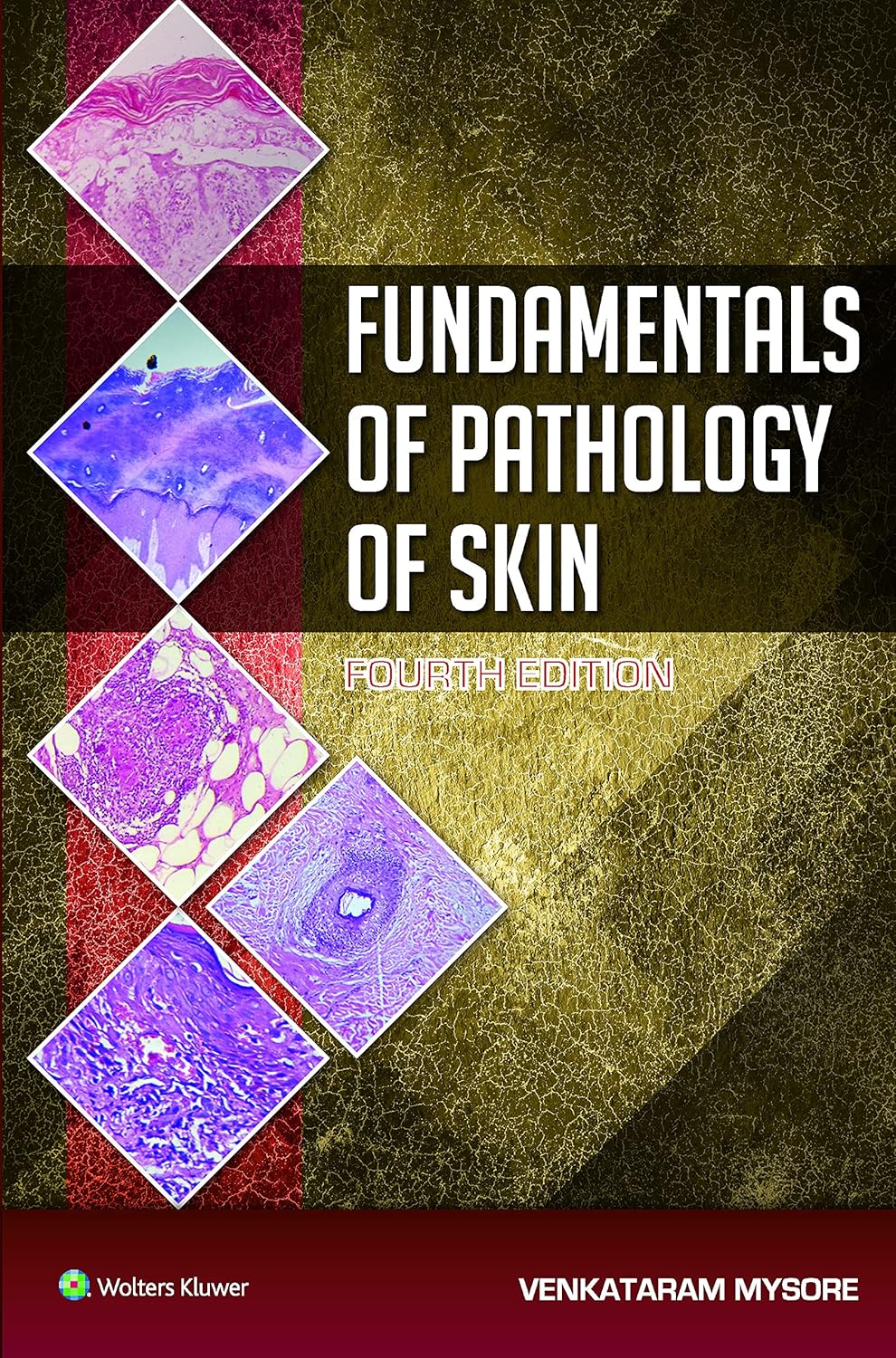 Fundamentals of Pathology of Skin - 4E